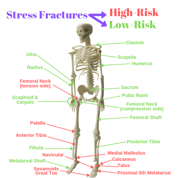 Do I Need A Boot For A Stress Fracture? What Exercises Help?