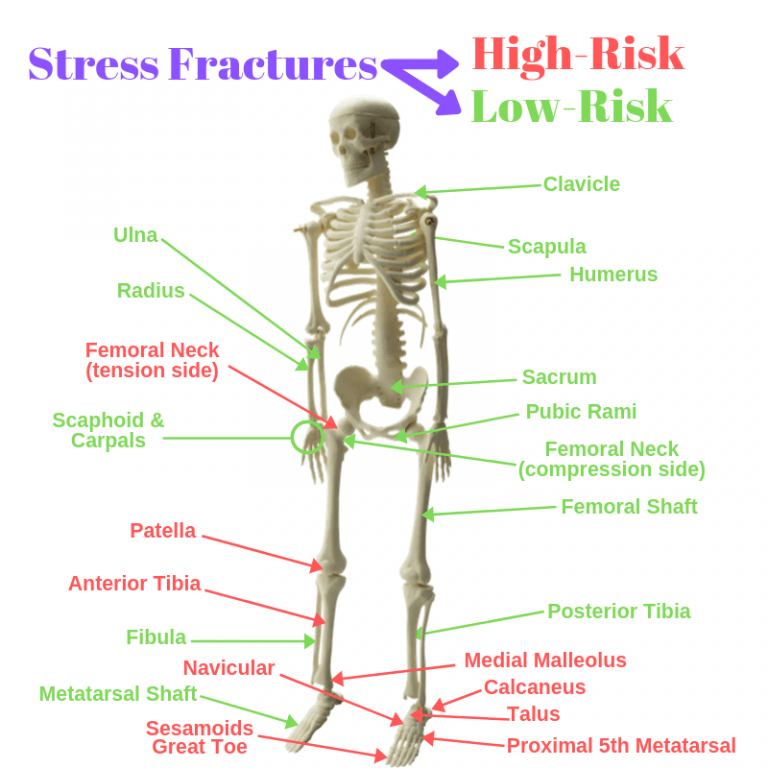 Do I need a boot for a stress fracture? What Exercises Help?